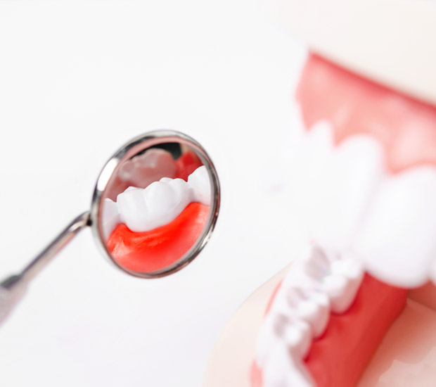 Tucson Interactive Periodontal Probing