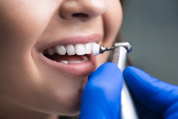The Importance Of Removing Plaque And Tartar With A Dental Cleaning
